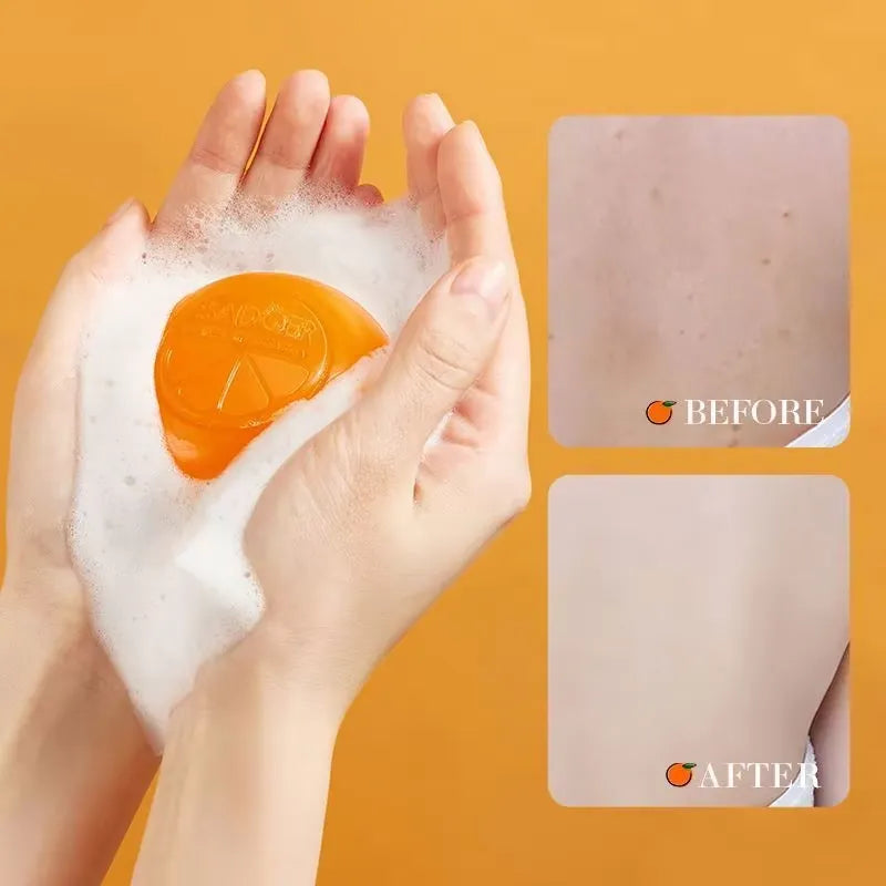 SADOER Vitamin C Whitening Soap 100g | Orange Extraction Essence